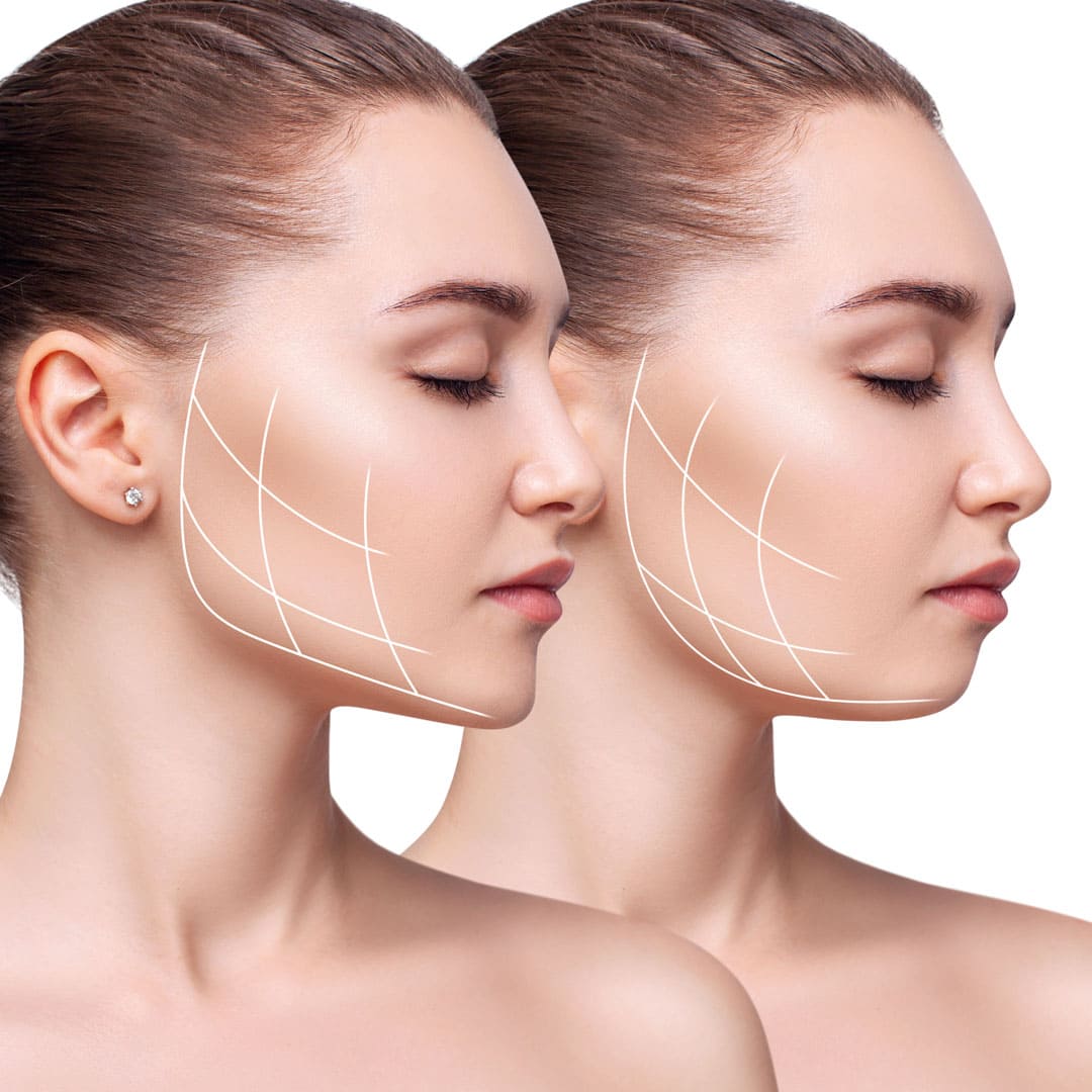 Lipolysis Treatment in DubaiFacial Treatment in Dubai